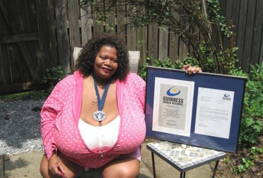 All Natural! Meet The Woman With The World's Largest Breast (PHOTOS)